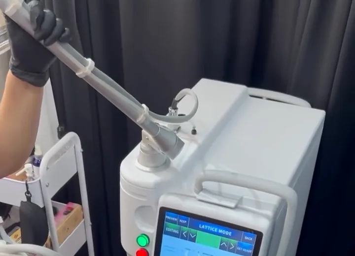 Brazo articulado del láser CO2 fraccionado durante la preparación de una sesión